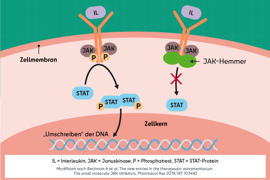 Schematische Darstellung JAK-STAT-Signalweg